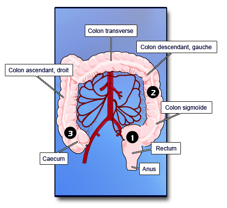 Limites de l'accès endoscopique au colon