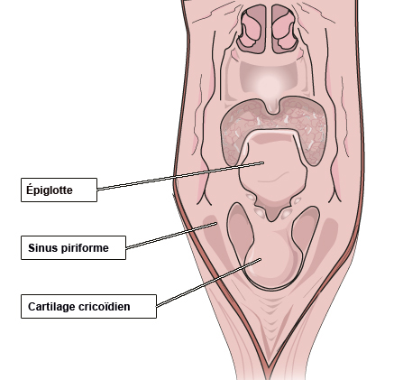 Sinus pyriforme
